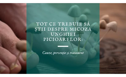 Tot ce trebuie să știi despre micoza unghiei picioarelor: Cauze, prevenție și tratament