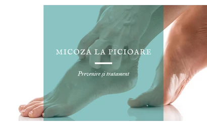 Prevenirea și tratarea micozei la picioare